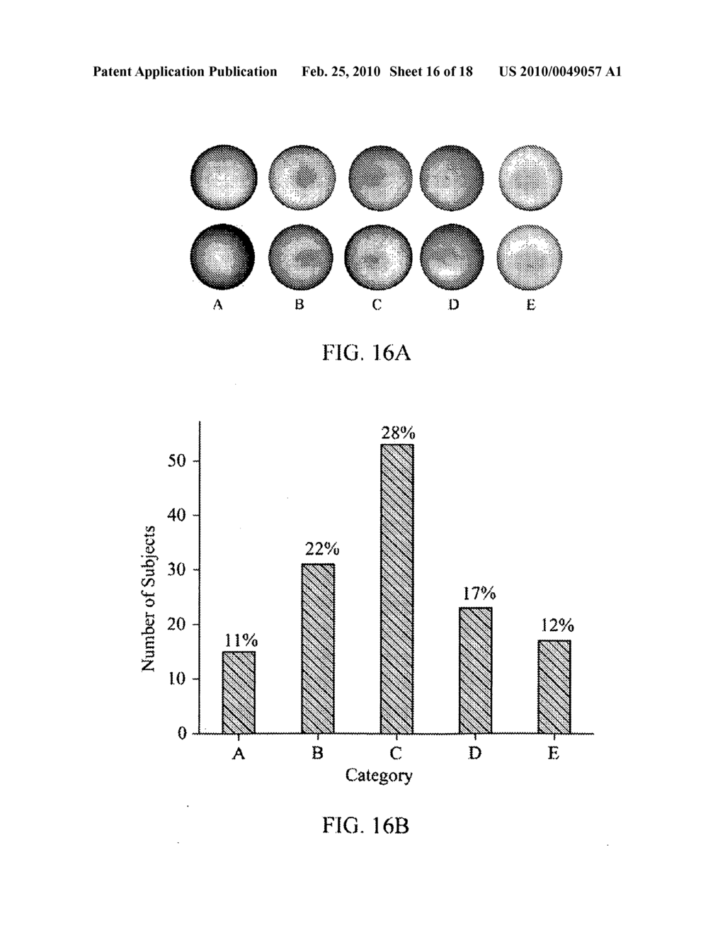 IMAGING OF MACULAR PIGMENT DISTRIBUTIONS - diagram, schematic, and image 17