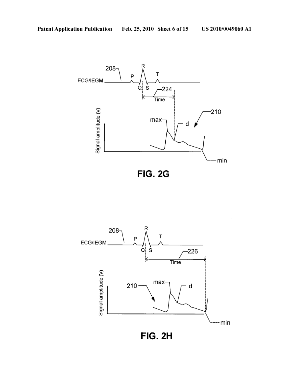 IMPLANTABLE HEMODYNAMIC MONITOR AND METHODS FOR USE THEREWITH - diagram, schematic, and image 07