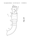 DETACHABLE TIP MICROCATHETER diagram and image