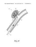 DETACHABLE TIP MICROCATHETER diagram and image