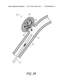 DETACHABLE TIP MICROCATHETER diagram and image