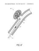 DETACHABLE TIP MICROCATHETER diagram and image