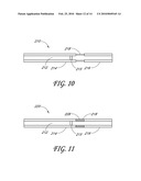 DETACHABLE TIP MICROCATHETER diagram and image