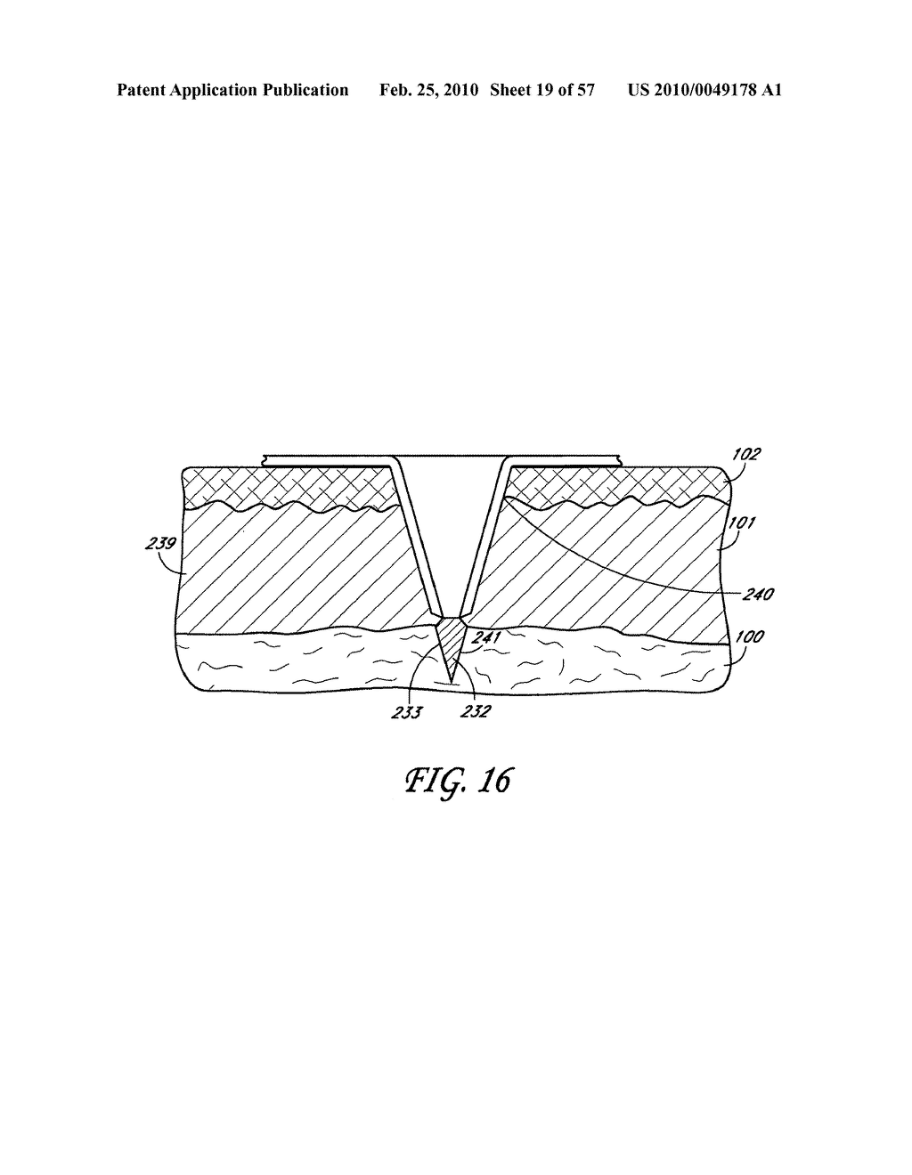 METHODS AND APPARATUS FOR REDUCING SWEAT PRODUCTION - diagram, schematic, and image 20