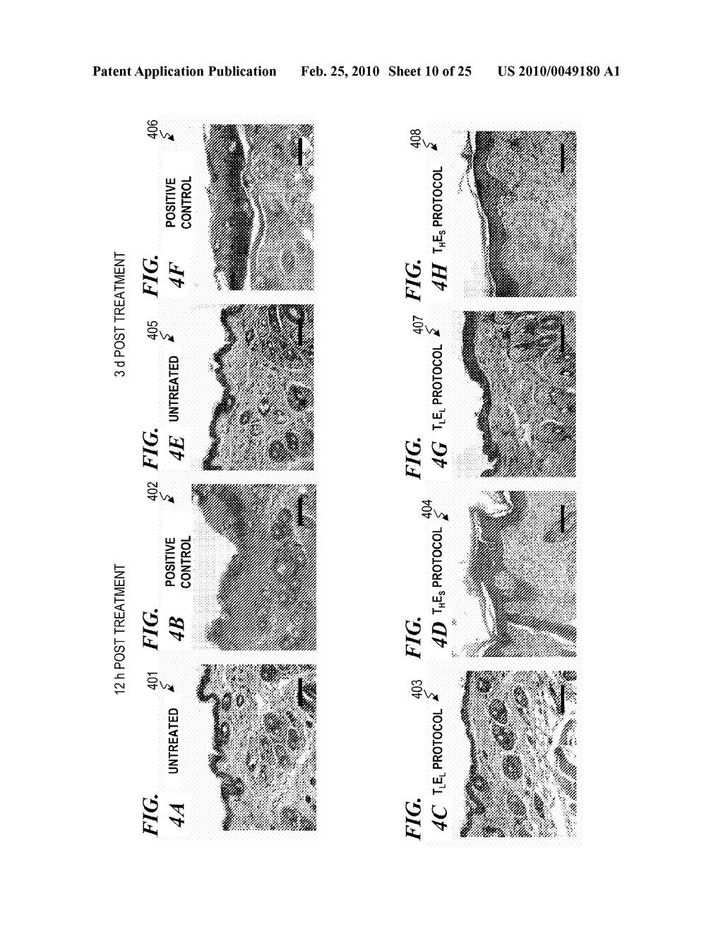 SYSTEM AND METHOD FOR CONDITIONING ANIMAL TISSUE USING LASER LIGHT - diagram, schematic, and image 11