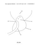 Non-Thermal Ablation System for Treating Tissue diagram and image