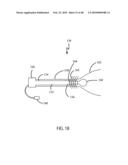 Non-Thermal Ablation System for Treating Tissue diagram and image