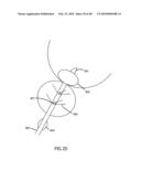 Non-Thermal Ablation System for Treating Tissue diagram and image