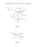 Non-Thermal Ablation System for Treating Tissue diagram and image