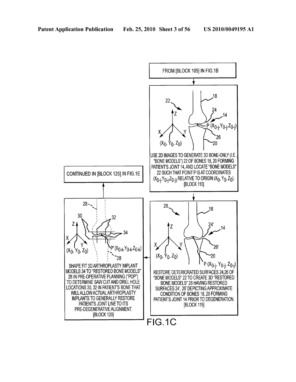 ARTHROPLASTY SYSTEM AND RELATED METHODS - diagram, schematic, and image 04