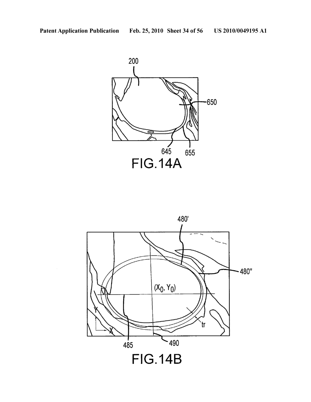 ARTHROPLASTY SYSTEM AND RELATED METHODS - diagram, schematic, and image 35