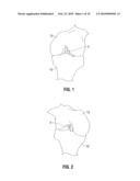 FEMORAL GUIDE FOR ACL REPAIR HAVING REDUCED PROFILE FOR LEFT/RIGHT KNEE CONFIGURATIONS diagram and image