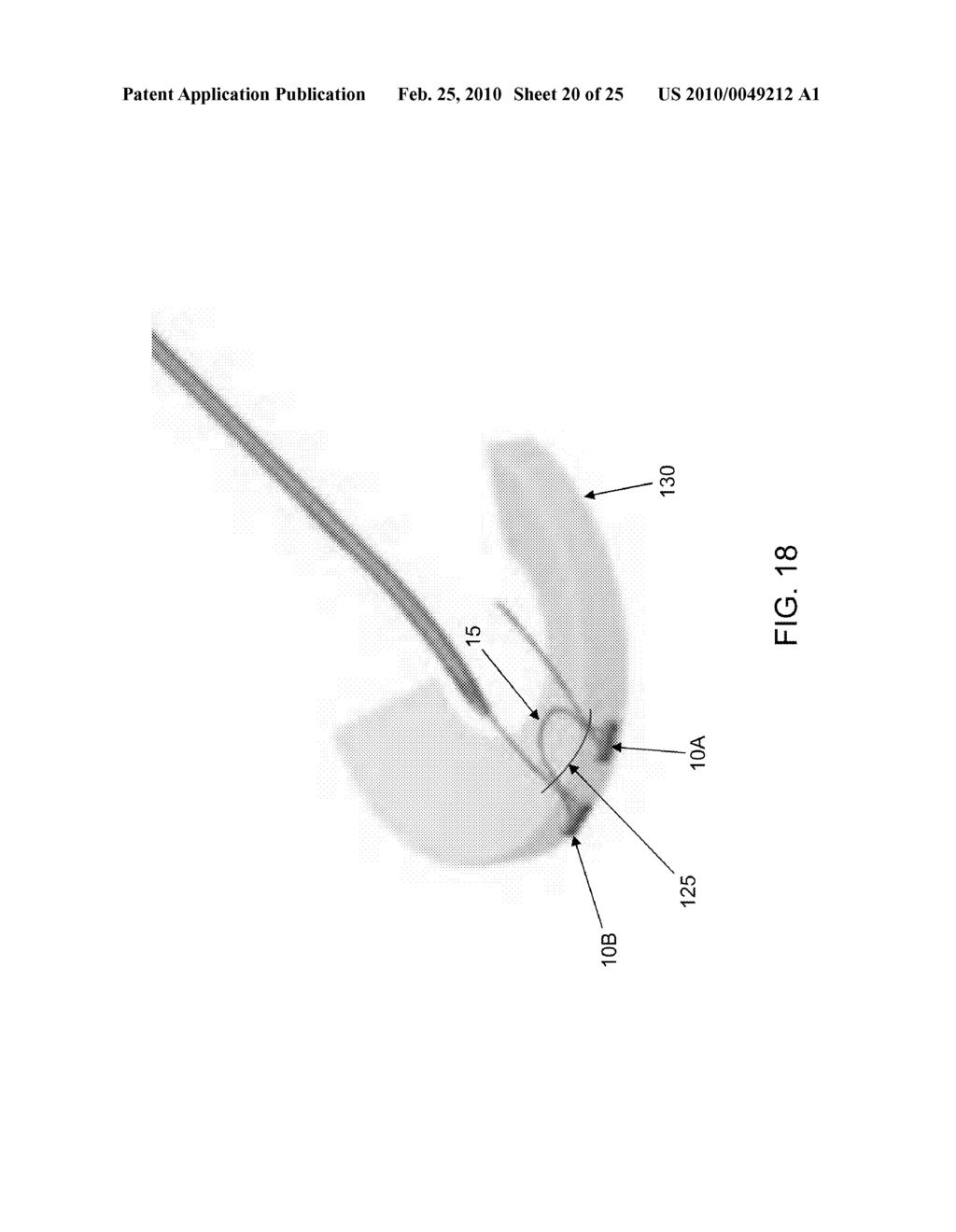 METHOD AND APPARATUS FOR MENISCAL REPAIR - diagram, schematic, and image 21