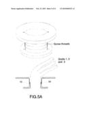 PROSTHESIS FOR ANASTOMOSIS diagram and image