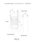 PROSTHESIS FOR ANASTOMOSIS diagram and image