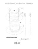 PROSTHESIS FOR ANASTOMOSIS diagram and image