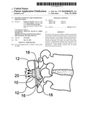 METHOD AND DEVICE FOR INTERSPINOUS PROCESS FUSION diagram and image