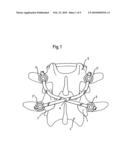 STABILIZATION DEVICE FOR THE DYNAMIC STABILIZATION OF VERTEBRAE OR BONES AND ROD LIKE ELEMENT FOR SUCH A STABILIZATION DEVICE diagram and image