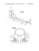 STABILIZATION DEVICE FOR THE DYNAMIC STABILIZATION OF VERTEBRAE OR BONES AND ROD LIKE ELEMENT FOR SUCH A STABILIZATION DEVICE diagram and image