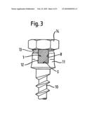 STABILIZATION DEVICE FOR THE DYNAMIC STABILIZATION OF VERTEBRAE OR BONES AND ROD LIKE ELEMENT FOR SUCH A STABILIZATION DEVICE diagram and image