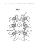 STABILIZATION DEVICE FOR THE DYNAMIC STABILIZATION OF VERTEBRAE OR BONES AND ROD LIKE ELEMENT FOR SUCH A STABILIZATION DEVICE diagram and image