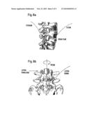 STABILIZATION DEVICE FOR THE DYNAMIC STABILIZATION OF VERTEBRAE OR BONES AND ROD LIKE ELEMENT FOR SUCH A STABILIZATION DEVICE diagram and image