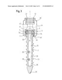 BONE ANCHORING DEVICE diagram and image