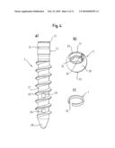 BONE ANCHORING DEVICE diagram and image