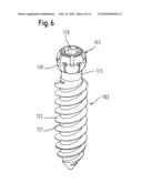 BONE ANCHORING DEVICE diagram and image