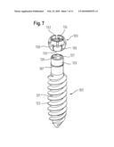 BONE ANCHORING DEVICE diagram and image