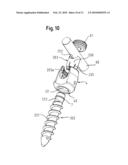 BONE ANCHORING DEVICE diagram and image