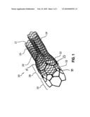 STENT WITH IMPROVED RESISTANCE TO MIGRATION diagram and image