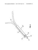 STENT WITH IMPROVED RESISTANCE TO MIGRATION diagram and image