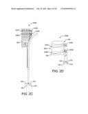 Controlled deployable medical device and method of making the same diagram and image