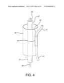 Side Branched Endoluminal Prostheses and Methods of Delivery Thereof diagram and image