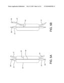 Side Branched Endoluminal Prostheses and Methods of Delivery Thereof diagram and image