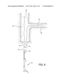 Side Branched Endoluminal Prostheses and Methods of Delivery Thereof diagram and image