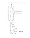 Side Branched Endoluminal Prostheses and Methods of Delivery Thereof diagram and image