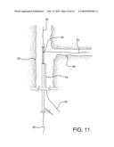 Side Branched Endoluminal Prostheses and Methods of Delivery Thereof diagram and image