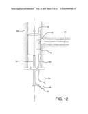 Side Branched Endoluminal Prostheses and Methods of Delivery Thereof diagram and image