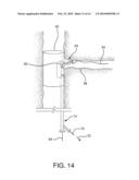 Side Branched Endoluminal Prostheses and Methods of Delivery Thereof diagram and image