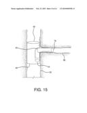 Side Branched Endoluminal Prostheses and Methods of Delivery Thereof diagram and image