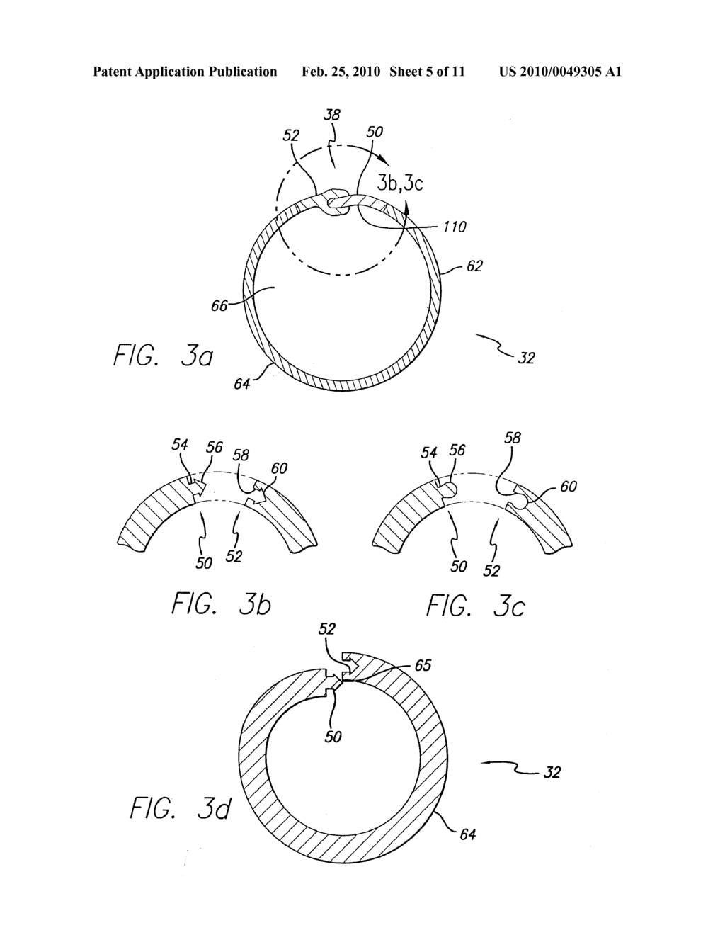 CONVERTIBLE DELIVERY SYSTEMS FOR MEDICAL DEVICES - diagram, schematic, and image 06