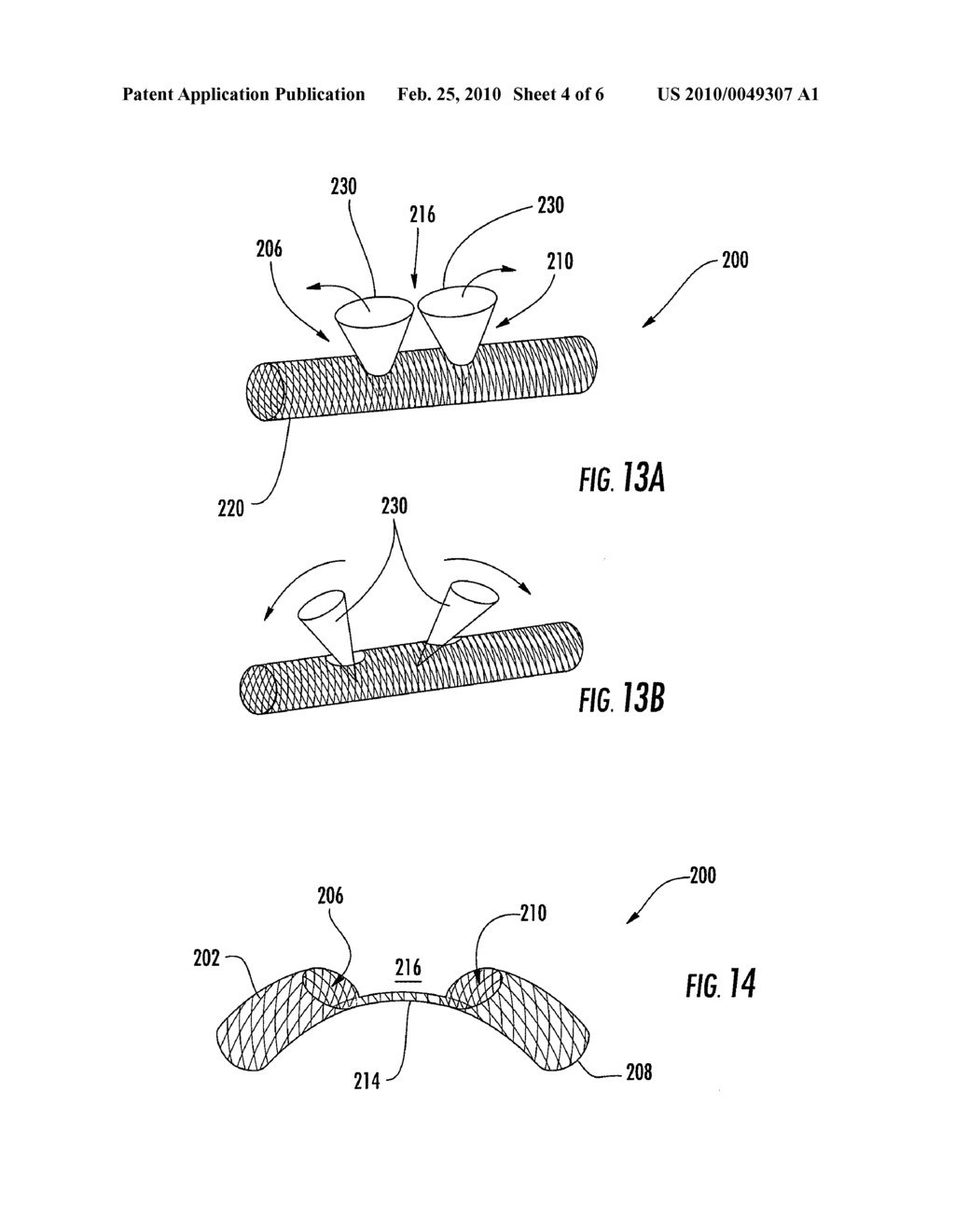 STENT GRAFT HAVING EXTENDED LANDING AREA AND METHOD FOR USING THE SAME - diagram, schematic, and image 05