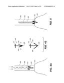 METHODS, DEVICES, AND KITS FOR TREATING MITRAL VALVE PROLAPSE diagram and image