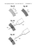 SELF-SEALING SHELL FOR INFLATABLE PROSTHESES diagram and image