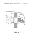 Implantable Housing With Stabilizer diagram and image