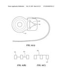 Implantable Housing With Stabilizer diagram and image