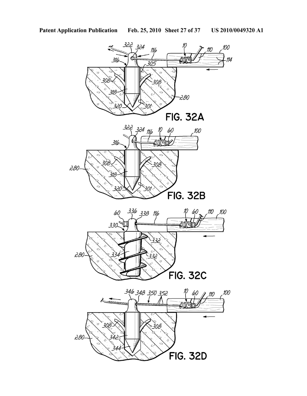 APPARATUS AND METHODS FOR TENDON OR LIGAMENT REPAIR - diagram, schematic, and image 28