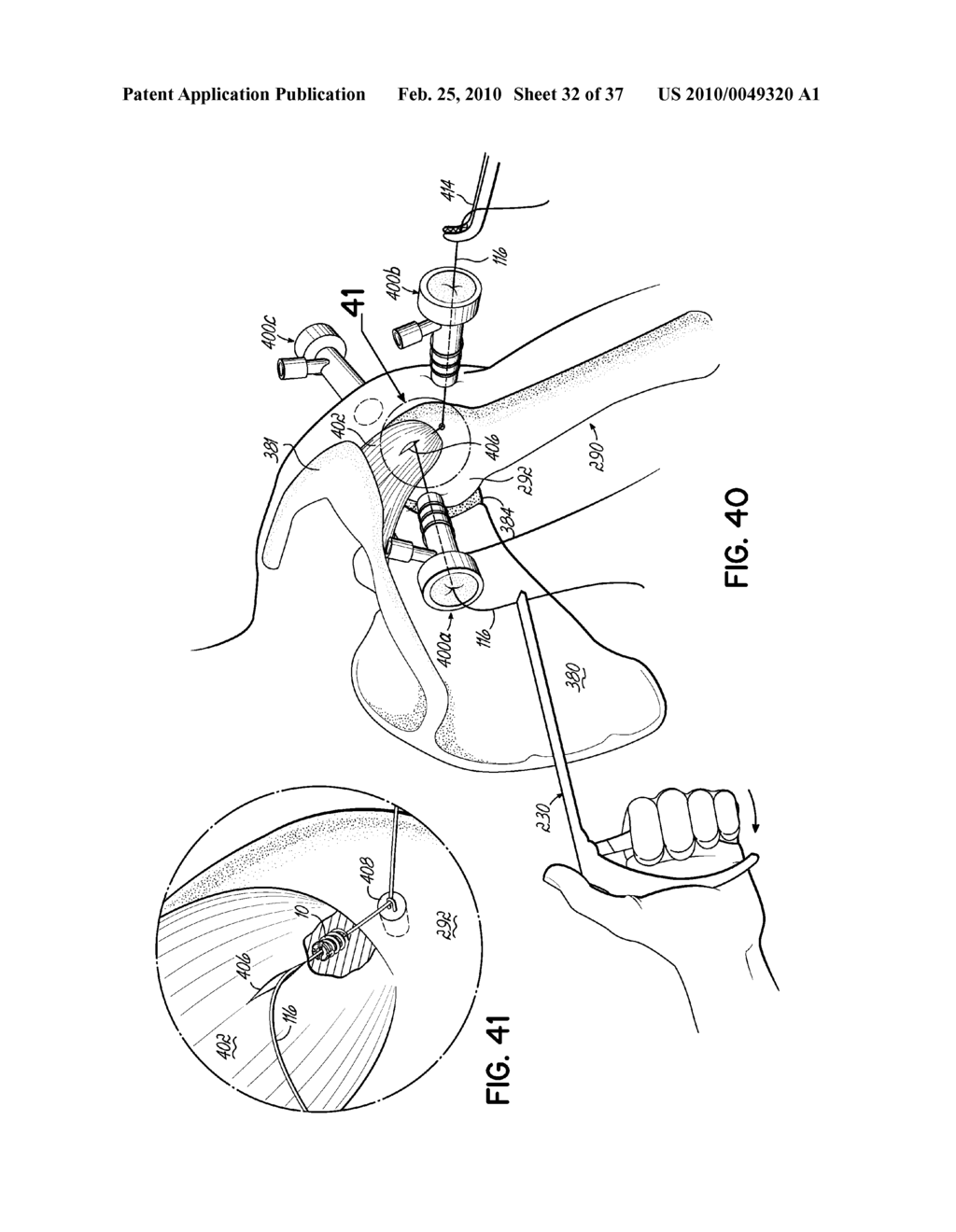 APPARATUS AND METHODS FOR TENDON OR LIGAMENT REPAIR - diagram, schematic, and image 33